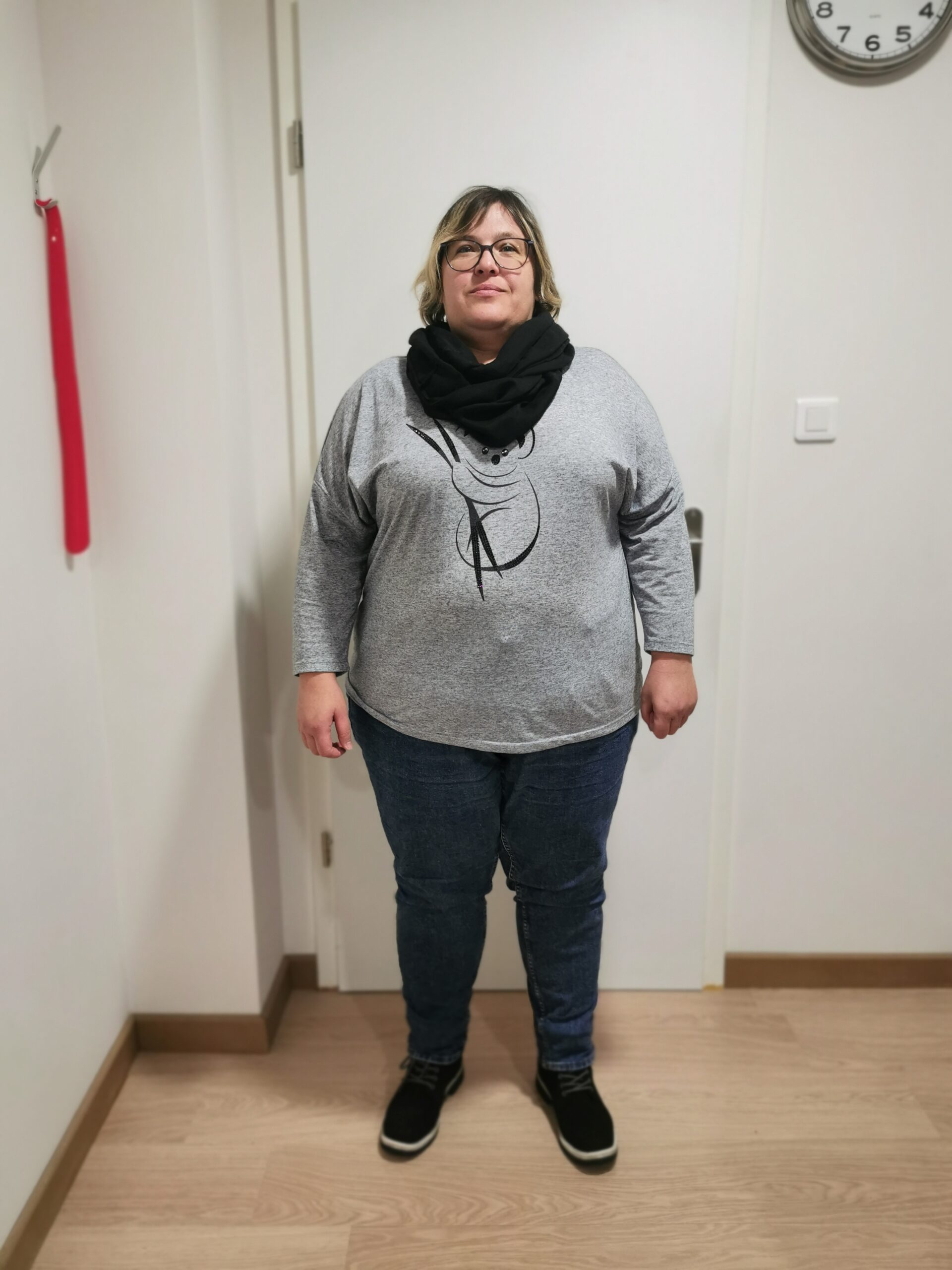 Audrey avant son rééquilibrage alimentaire